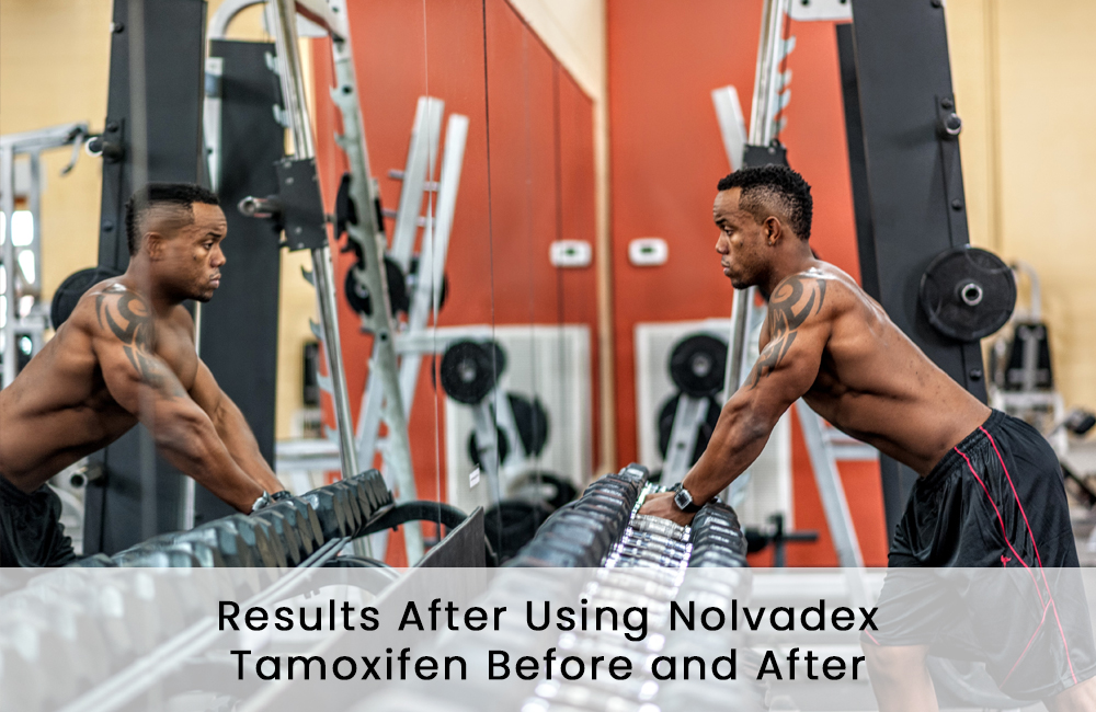 Results After Using Nolvadex – Tamoxifen Before and After